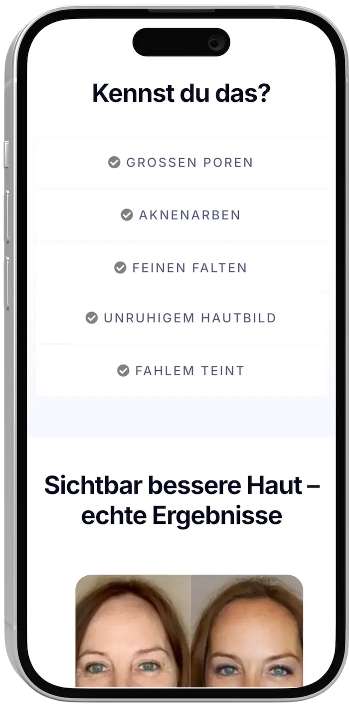 Mobile Ansicht des Beauty Funnels mit Headline, Angebotslogik und Termin-Button